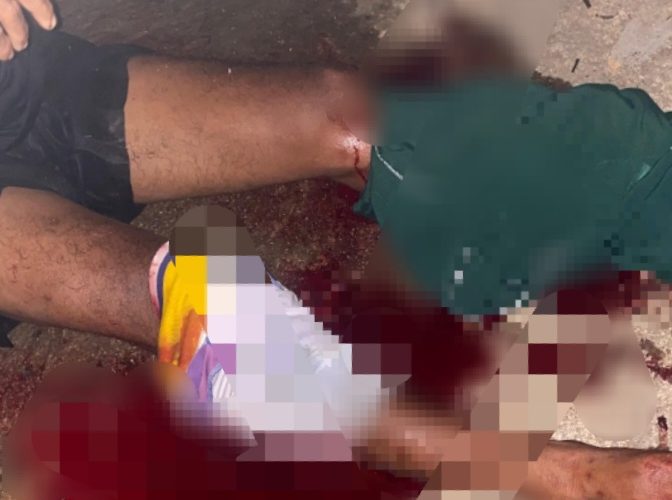 Nelayan Desa Penaga Diterkam Buaya Saat Hendak Melaut, Selamat Setelah Colok Mata Buaya