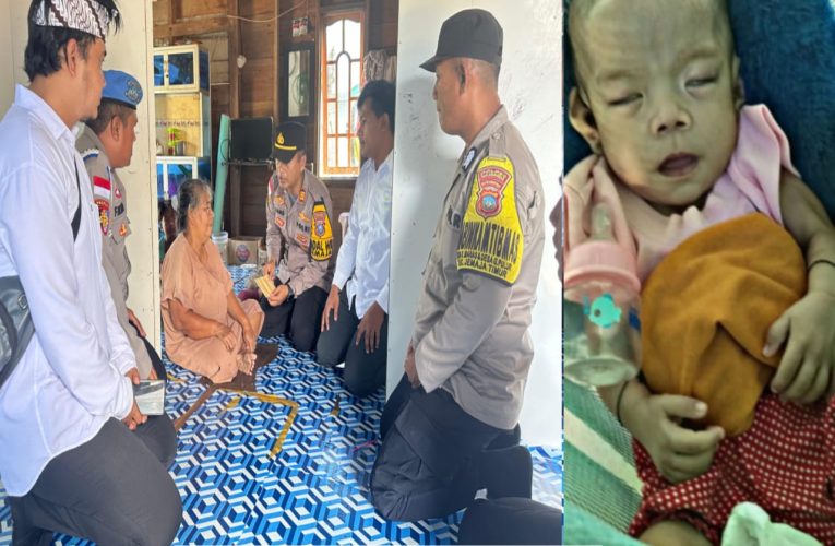 Polsek Jemaja Berikan Bantuan Sosial kepada Bayi 6 Bulan Penderita Penyakit Jantung Bawaan
